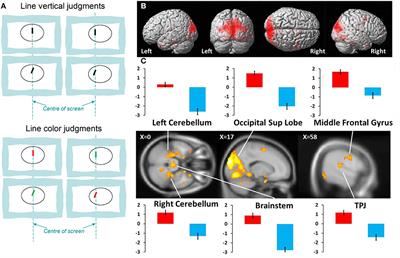 Functional Neuroanatomy of Vertical Visual Perception in Humans